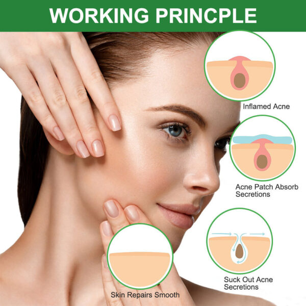 Colloidal Invisible Acne Patch Acne Patch To Clean Acne And Eliminate Acne - Image 3